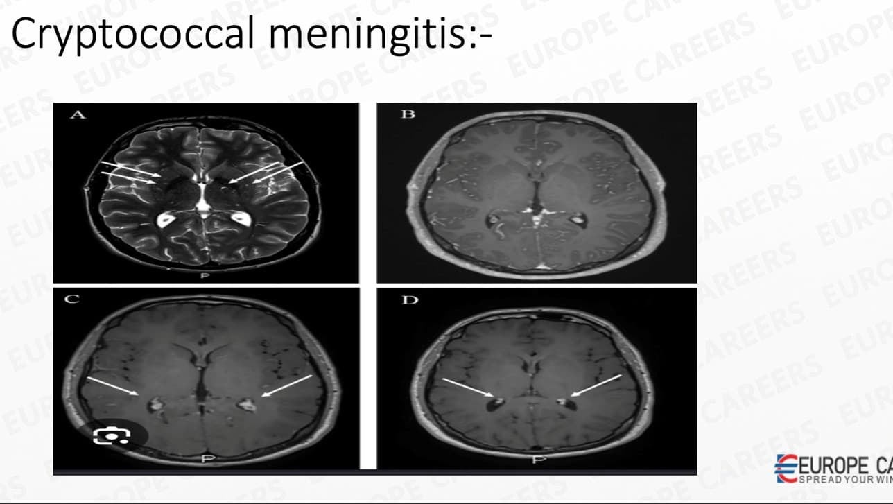 Pre-med preparation 6